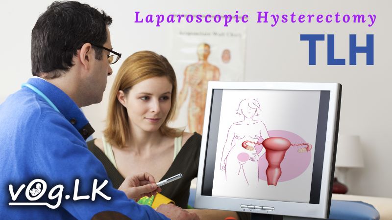 total-laparoscopic-hysterectomy