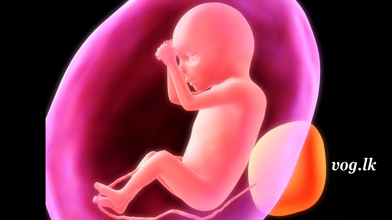 බබා හැරිල නැති නම් මොකද වෙන්නේ? Breech presentation in late pregnancy